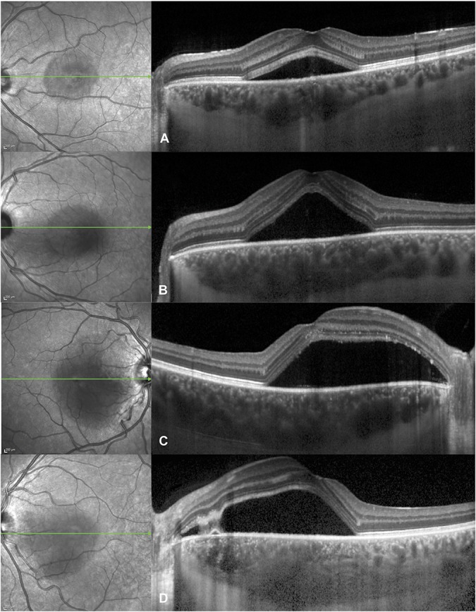 Fig. 2.