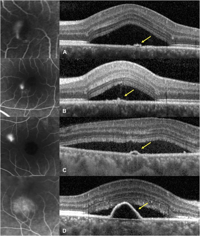 Fig. 4.