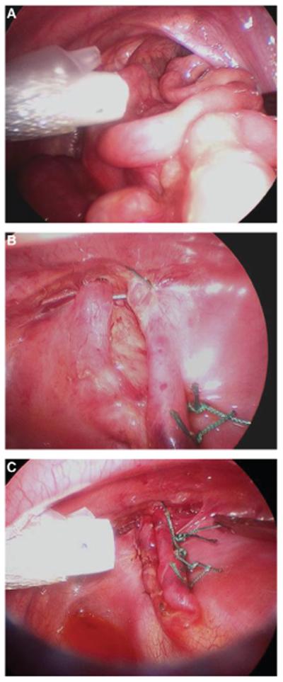 FIG. 1