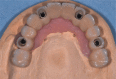Figure 17