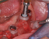 Figure 22