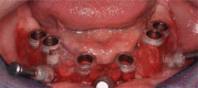 Figure 20