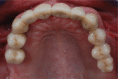 Figure 14a