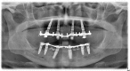Figure 28