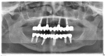 Figure 30