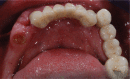 Figure 14b