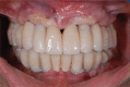 Figure 26