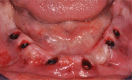 Figure 25