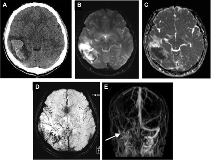 Fig. 1