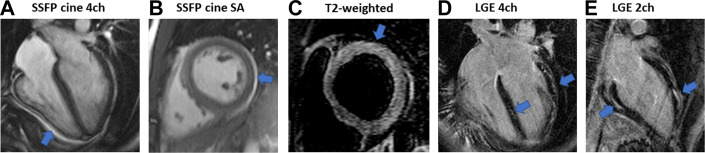 Fig. 3