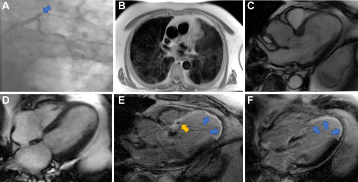 Fig. 4