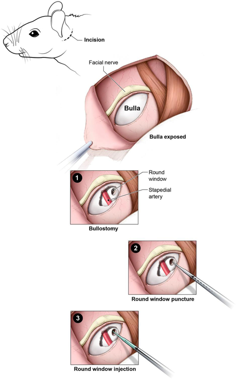 Figure 1: