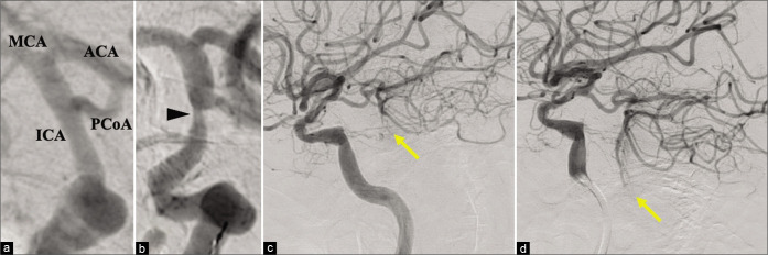 Figure 2: