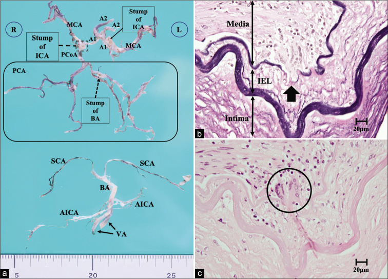 Figure 4: