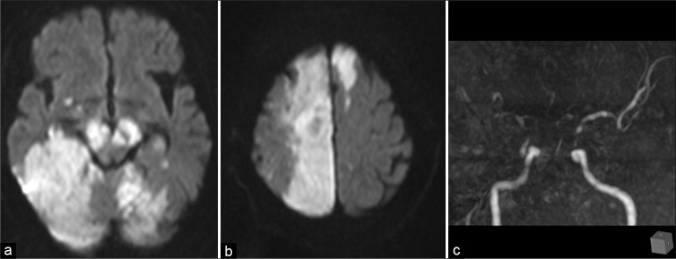 Figure 3: