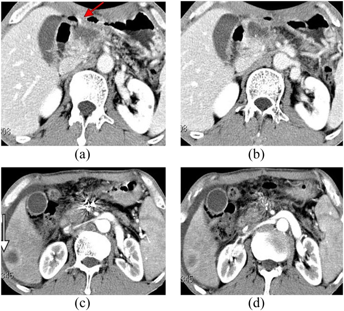 Figure 4.