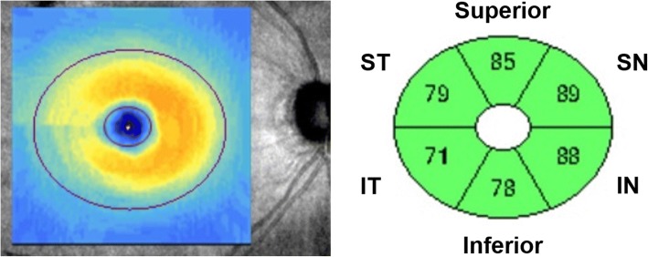 Fig. 1