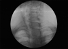 Figure 1c