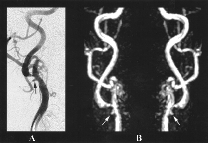 fig 1.