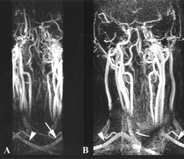 fig 2.