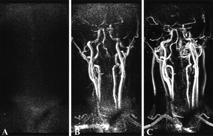 fig 3.