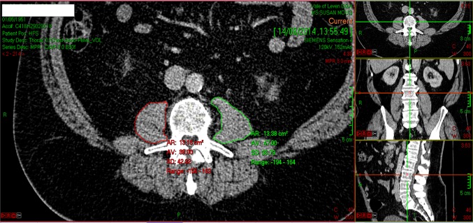 Fig. 1