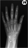 Fig. 2