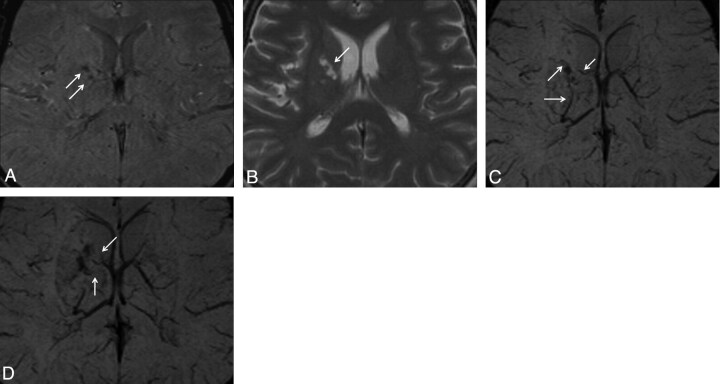 Fig 2.