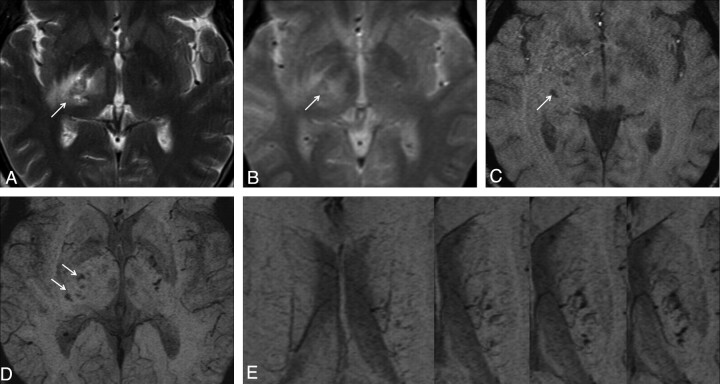 Fig 1.