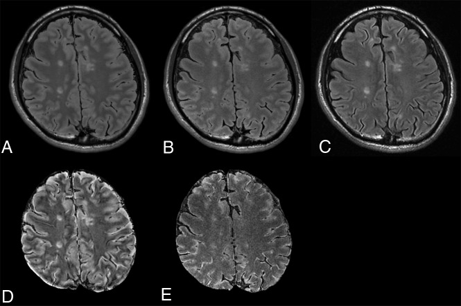 Fig 2.