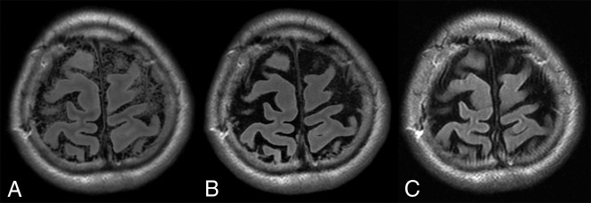 Fig 3.