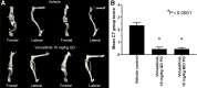 Figure 4. Vimseltinib inhibition of bone degradation. A, Representative images are shown of the right hind limbs from 2 vehicle-treated mice and 2 mice treated with vimseltinib at 10 mg/kg every day in the PC3 peritibial bone invasion mouse model. B, Qualitative analysis of CT images of right hind limbs of all animals on study (n = 20/cohort).