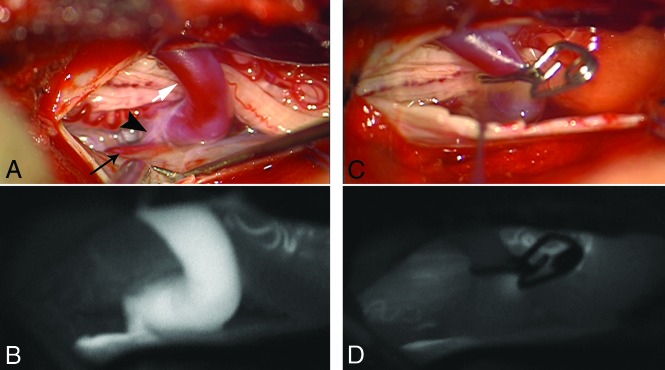 FIG 4.