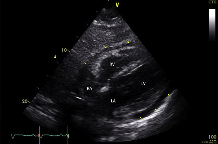 Figure 2