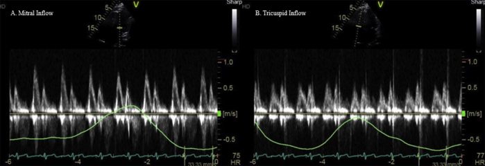 Figure 4