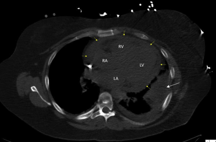 Figure 1