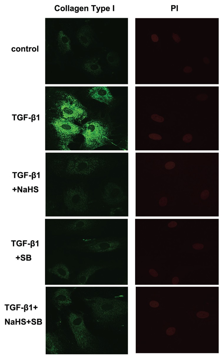 Figure 11