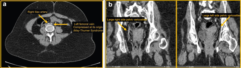 Fig 1