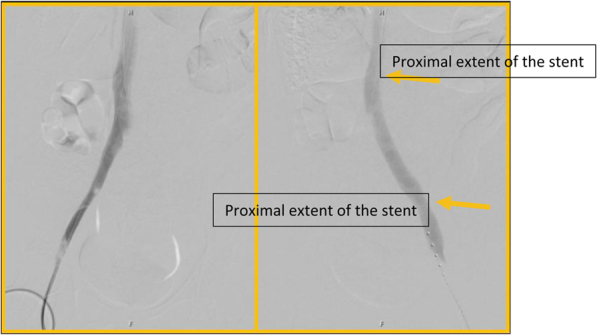 Fig 3