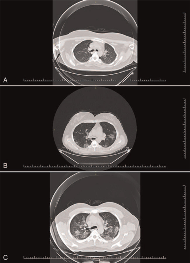 FIGURE 1