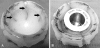 Fig. 3A–B