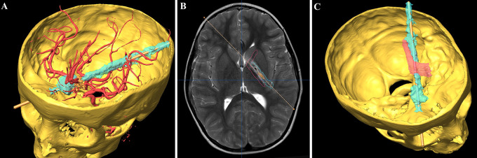 FIG. 4.