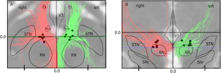 Fig. 3