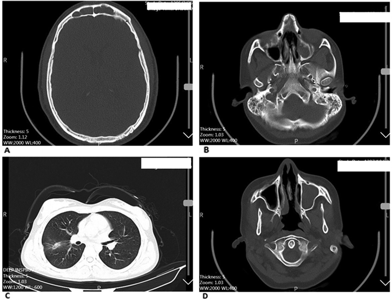 Fig. 13
