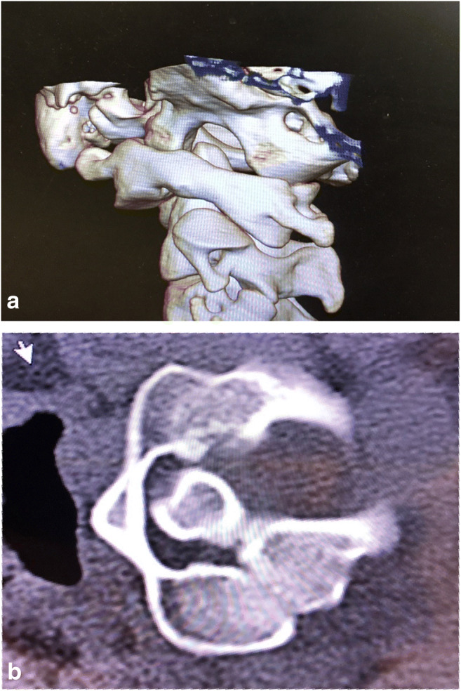 Fig. 2