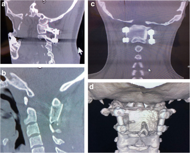 Fig. 4