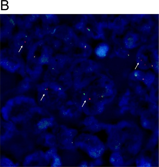 Figure 1B