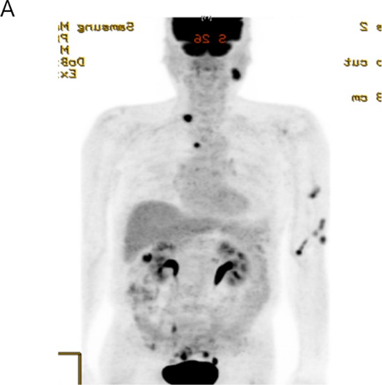 Figure 3A