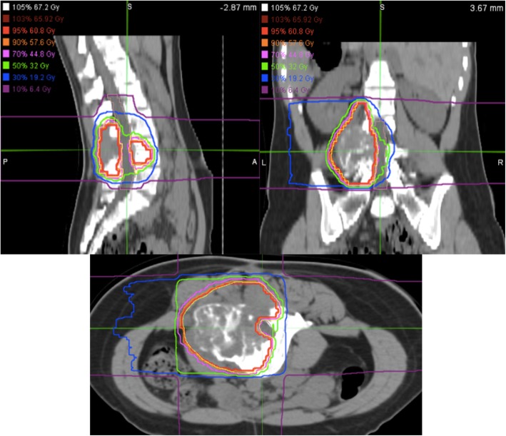 Fig. 6