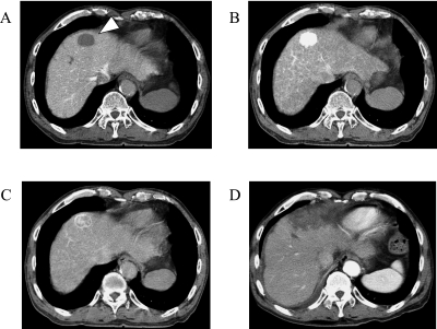 Fig. 4